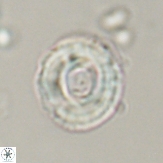 Toweius callosus 54729