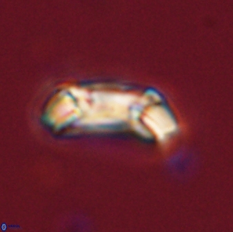 Toweius callosus 54746