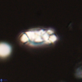 Toweius distinctus 58790