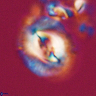 Toweius ektopisma 22177