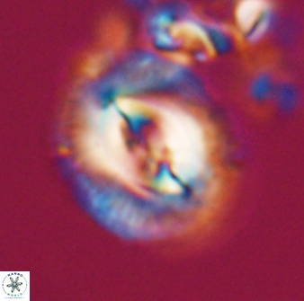Toweius ektopisma 22177