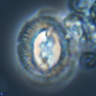 Toweius ektopisma 22183