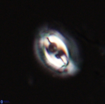 Toweius ektopisma 23220