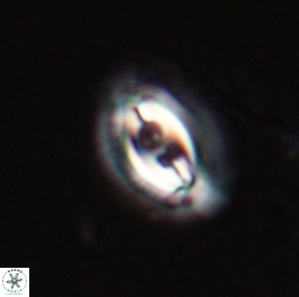 Toweius ektopisma 23220