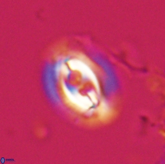 Toweius ektopisma 23221