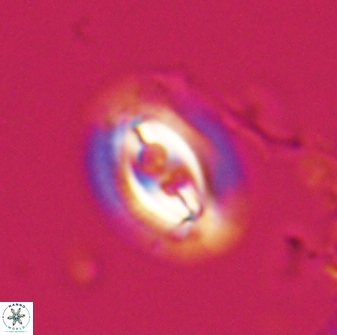 Toweius ektopisma 23221