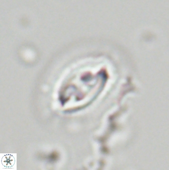 Toweius ektopisma 23224