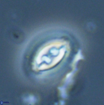 Toweius ektopisma 23225
