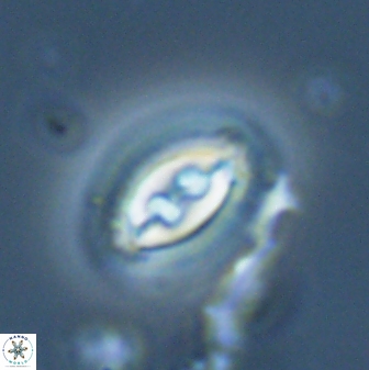 Toweius ektopisma 23225
