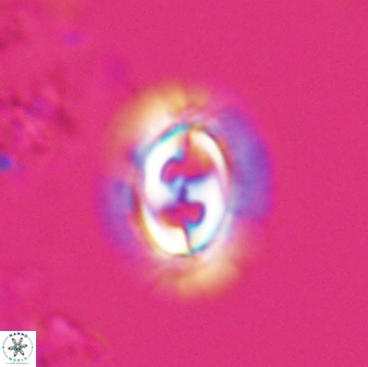 Toweius ektopisma 24619