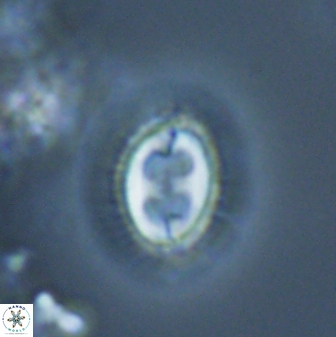 Toweius ektopisma 24626