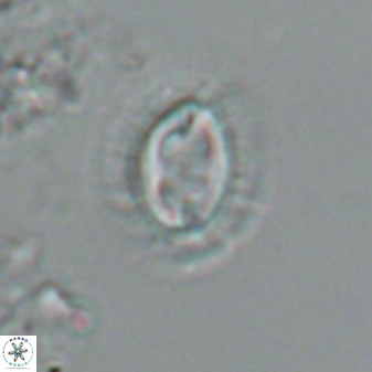 Toweius ektopisma 24627