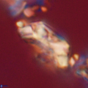 Toweius eminens 20607