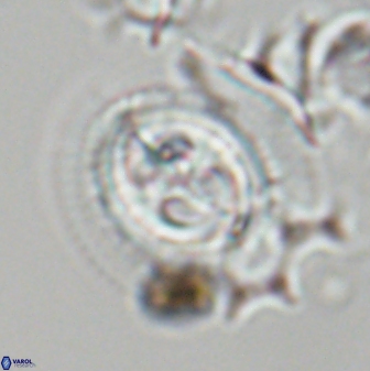 Toweius eminens 23234