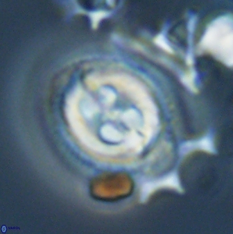 Toweius eminens 23235