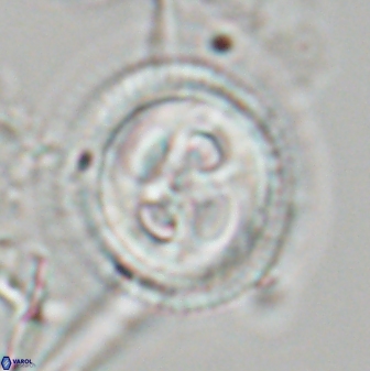 Toweius eminens 23242