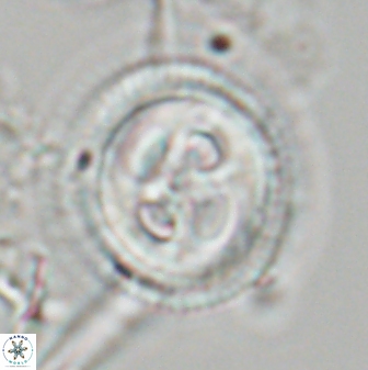 Toweius eminens 23242