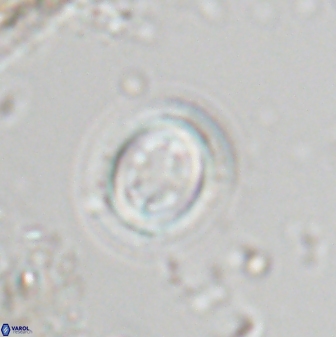 Toweius eminens 25185
