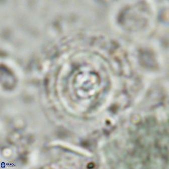 Toweius eminens 49587