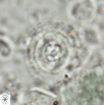 Toweius eminens 49587