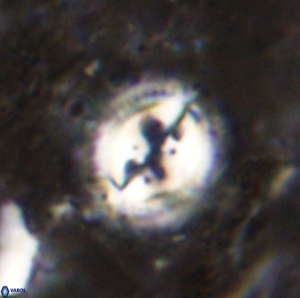 Toweius fusiformis 49621