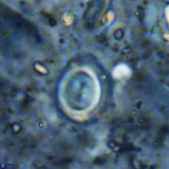 Toweius lamperos 50512