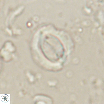 Toweius lamperos 60744