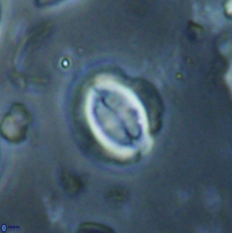 Toweius lamperos 60745