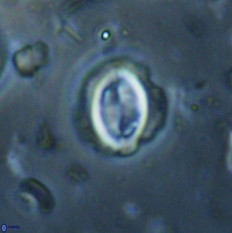 Toweius lamperos 60746