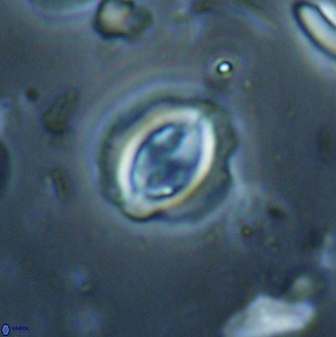 Toweius lamperos 60747