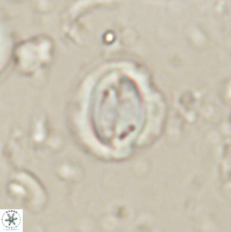 Toweius lamperos 60743