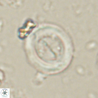Toweius lamperos 60785
