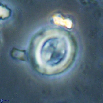 Toweius lamperos 60789