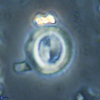Toweius lamperos 60790
