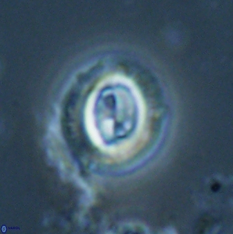 Toweius lamperos 60835