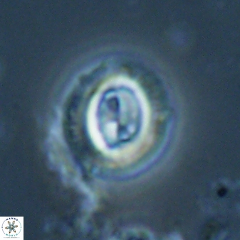 Toweius lamperos 60835