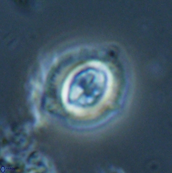 Toweius lamperos 60837