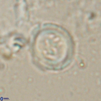 Toweius lamperos 60864