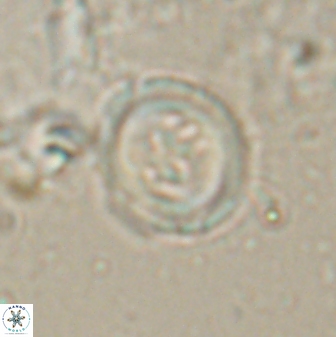 Toweius lamperos 60864