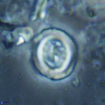 Toweius lamperos 60866