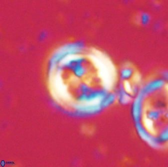 Toweius lamperos 60939