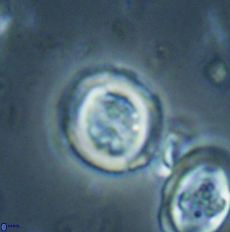 Toweius lamperos 60949