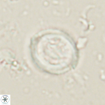 Toweius lamperos 61006