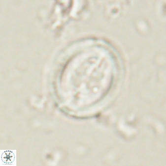 Toweius lamperos 61010