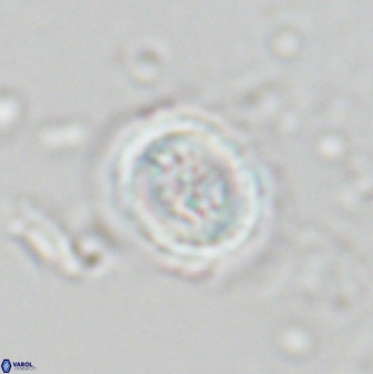 Toweius pertusus 24867