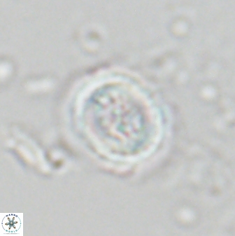 Toweius pertusus 24867