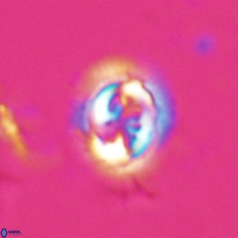Toweius pertusus 24874