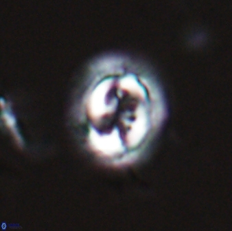 Toweius pertusus 24875