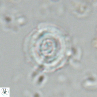 Toweius pertusus 25751