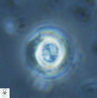 Toweius pertusus 25752